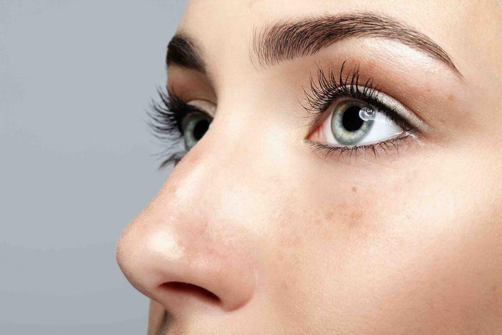 Rinoplastie
